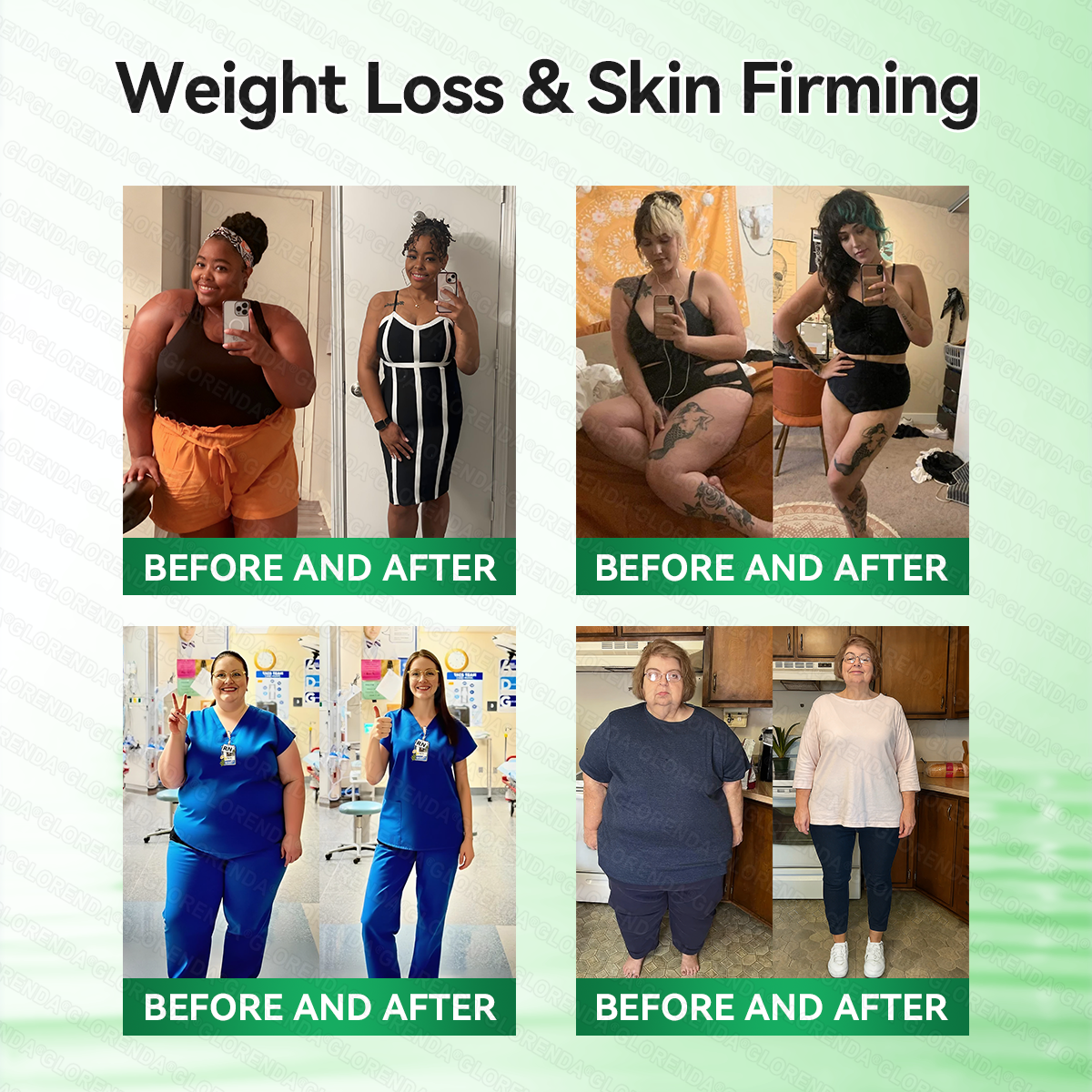 𝑶𝒇𝒇𝒊𝒄𝒊𝒂𝒍 𝑺𝒕𝒐𝒓𝒆  | 👨‍⚕️𝐆𝐋𝐎𝑹𝑬𝑵𝑫𝗔®𝑴𝒐𝒓𝒊𝒏𝒈𝗮 · 𝗕𝗲𝗿𝗯𝗲𝗿𝙞𝙣𝙚 × 𝙉𝘼𝐃+ 𝟏𝟎-𝐢𝐧-𝟏 𝗔𝗱𝘃𝗮𝗻𝗰𝙚𝙙 𝙉𝙖𝙣𝙤 𝙈𝙞𝙘𝙧𝙤𝙣𝙚𝙚𝐝𝐥𝐞 𝐏𝐚𝐭𝙘𝙝🇺🇸(𝐉𝐮𝐬𝐭 𝐨𝐧𝐜𝐞 𝐚 𝐝𝐚𝐲, 𝐯𝐢𝐬𝐢𝐛𝐥𝐞 𝐜𝐡𝐚𝐧𝐠𝐞𝐬 𝐢𝐧 𝟕 𝐝𝐚𝐲𝐬） ✅ 𝐅𝐨𝐫 𝐨𝐛𝐞𝐬𝐢𝐭𝐲, 🅛🅞🅞🅢🅔 🅢🅚🅘🅝,𝐝𝐢𝐚𝐛𝐞𝐭𝐞𝐬, 𝐬𝐥𝐞𝐞𝐩 𝐚𝐩𝐧𝐞𝐚, 𝐣𝐨𝐢𝐧𝐭 𝐢𝐬𝐬𝐮𝐞𝐬, 𝐚𝐧𝐝 𝐦𝐨𝐫𝐞