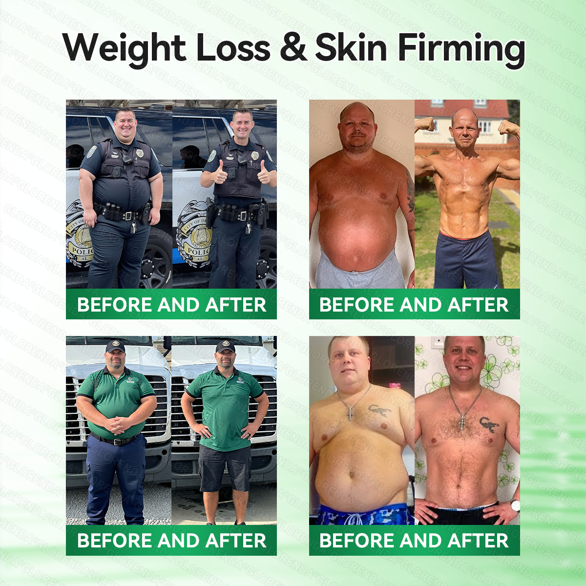 𝑶𝒇𝒇𝒊𝒄𝒊𝒂𝒍 𝑺𝒕𝒐𝒓𝒆  | 👨‍⚕️𝐆𝐋𝐎𝑹𝑬𝑵𝑫𝗔®𝑴𝒐𝒓𝒊𝒏𝒈𝗮 · 𝗕𝗲𝗿𝗯𝗲𝗿𝙞𝙣𝙚 × 𝙉𝘼𝐃+ 𝟏𝟎-𝐢𝐧-𝟏 𝗔𝗱𝘃𝗮𝗻𝗰𝙚𝙙 𝙉𝙖𝙣𝙤 𝙈𝙞𝙘𝙧𝙤𝙣𝙚𝙚𝐝𝐥𝐞 𝐏𝐚𝐭𝙘𝙝🇺🇸(𝐉𝐮𝐬𝐭 𝐨𝐧𝐜𝐞 𝐚 𝐝𝐚𝐲, 𝐯𝐢𝐬𝐢𝐛𝐥𝐞 𝐜𝐡𝐚𝐧𝐠𝐞𝐬 𝐢𝐧 𝟕 𝐝𝐚𝐲𝐬） ✅ 𝐅𝐨𝐫 𝐨𝐛𝐞𝐬𝐢𝐭𝐲, 🅛🅞🅞🅢🅔 🅢🅚🅘🅝,𝐝𝐢𝐚𝐛𝐞𝐭𝐞𝐬, 𝐬𝐥𝐞𝐞𝐩 𝐚𝐩𝐧𝐞𝐚, 𝐣𝐨𝐢𝐧𝐭 𝐢𝐬𝐬𝐮𝐞𝐬, 𝐚𝐧𝐝 𝐦𝐨𝐫𝐞